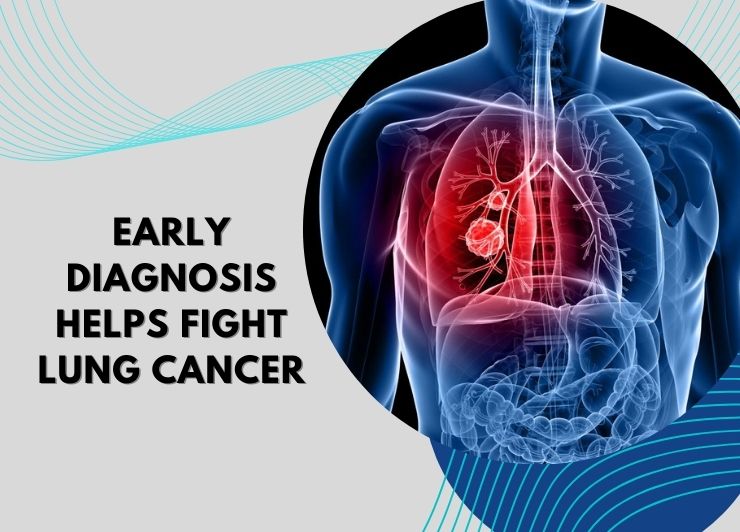Early-Diagnosis-Helps-Fight-Lung-Cancer-1.jpg